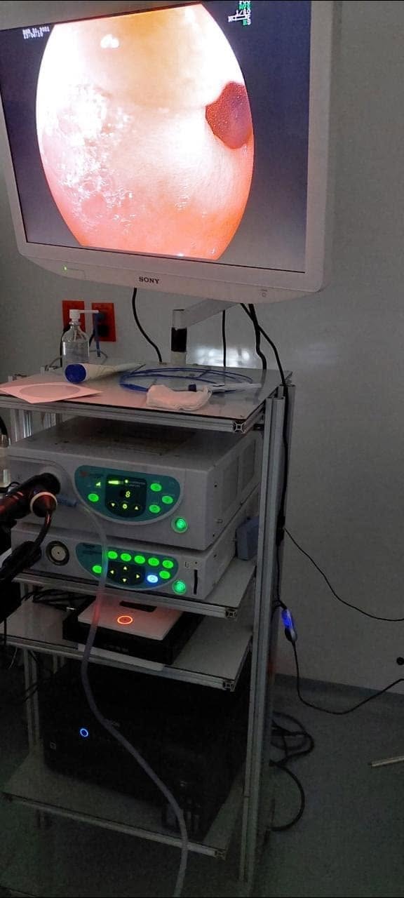 Equipo de endoscopia Puebla