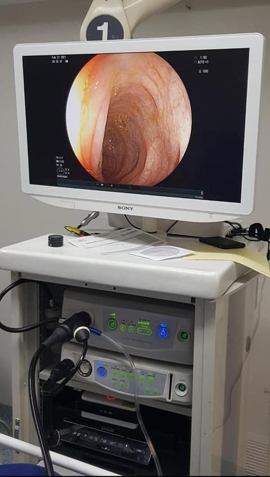Equipo endoscopia CDMX